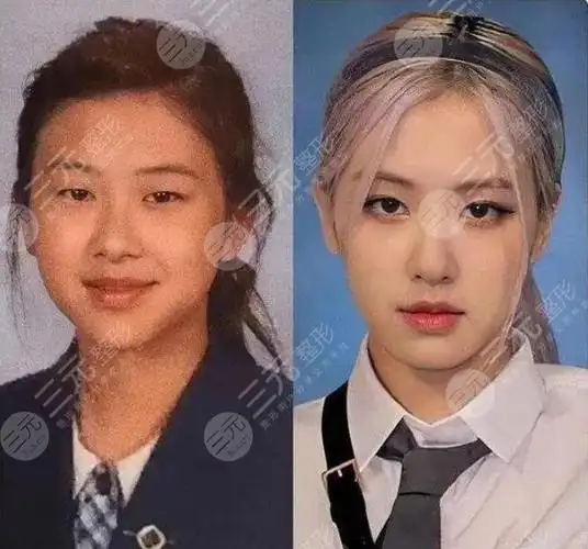 blackpink朴彩英整容实锤了?旧照曝光对比现在大变脸!粉丝却不认?